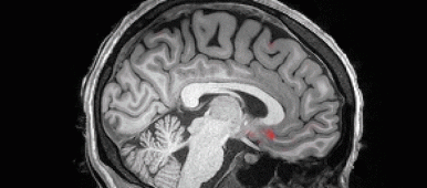 Animated image of brain during sleep