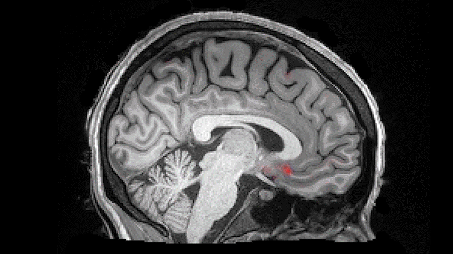 Animated image of brain during sleep