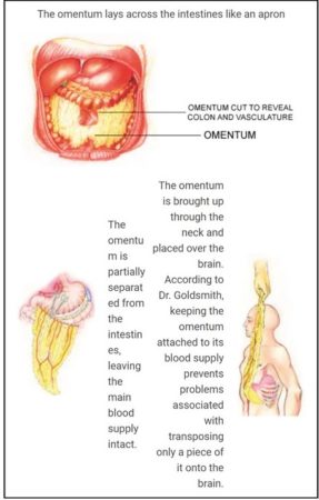 Omentum Image - Dr Harry S Goldsmith - LifeExtension.com