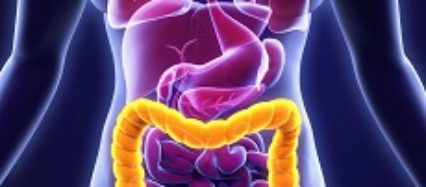 ColonicPolyps - NIH MedlinePlus